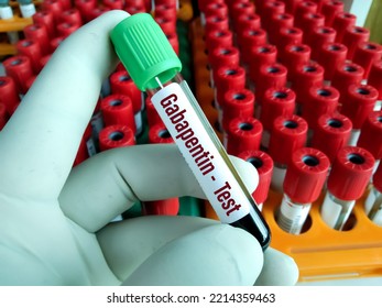 Blood Sample For Gabapentin Level Test. Set Therapeutic Dose. Epilepsy, Seizures.