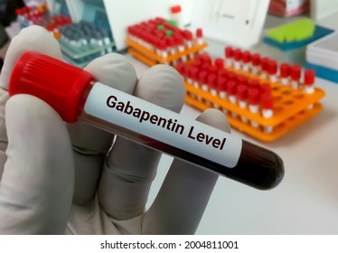 Blood Sample For Gabapentin Test.  Set Therapeutic Dose. Epilepsy, Seizures.