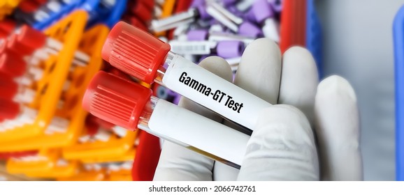 Blood Sample For Gamma GT(Gamma Glutamyl Transpeptidase) Test, Liver Enzyme