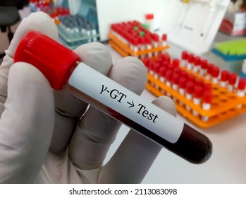 Blood Sample For Gamma-glutamyl Transferase Or Gamma GT Test, Liver Enzyme