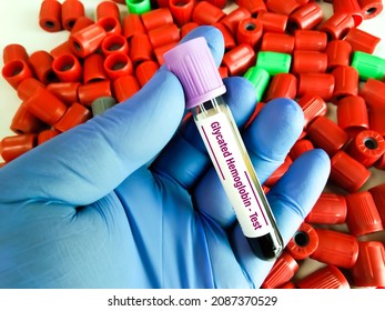 Blood Sample For Glycated Hemoglobin Or HbA1c Test, Diabetic Treatment Monitoring Test