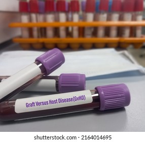 Blood Sample For Graft Versus Host Disease(GvHD). Condition That Might Occur After An Allogeneic Transplant Which Someone Receives Bone Marrow Tissue Or Cells From A Donor.
