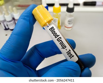 Blood Sample For Blood Group Testing