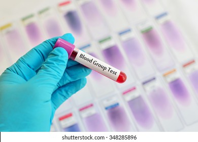 Blood Sample For Blood Group Testing