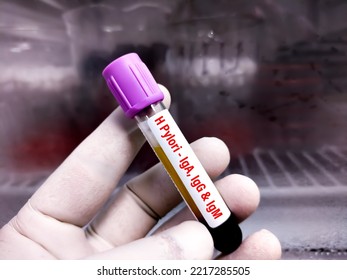 Blood Sample For H. Pylori (IgA, IgG And IgM) Test, Helicobacter Pylori Test, To Diagnose Helicobacter Pylori (H. Pylori) Infection