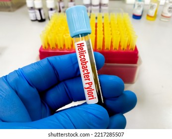 Blood Sample For H. Pylori (IgA, IgG And IgM) Test, Helicobacter Pylori Test, To Diagnose Helicobacter Pylori (H. Pylori) Infection