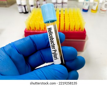 Blood Sample For H. Pylori (IgA, IgG And IgM) Test, Helicobacter Pylori Test, To Diagnose Helicobacter Pylori (H. Pylori) Infection