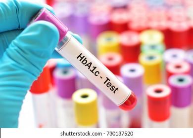 Blood Sample For HbA1c Test, Diabetes Diagnosis 