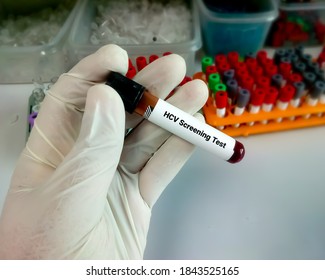 Blood Sample For HCV (Hepatitis C Virus) Screening Test. Technician Hold Test Tube. Health And Medical Concept.