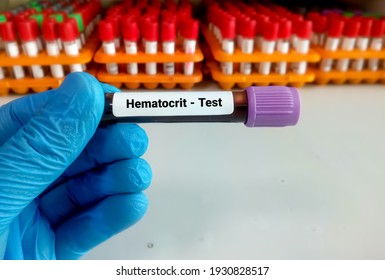 Blood Sample For Hematocrit, HTC, MCV