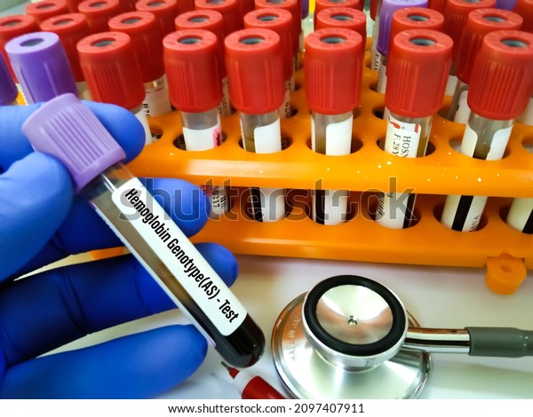 Blood Sample Hemoglobin Genotype Aa Asss Stock Photo 2097407911 ...