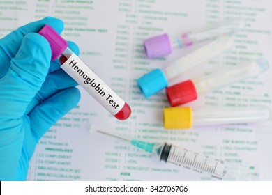 Blood Sample For Hemoglobin Test