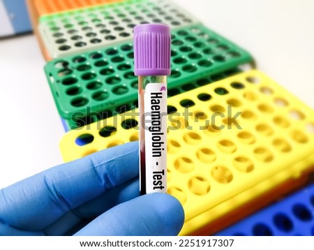 Blood sample for hemoglobin test