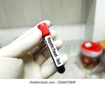 Blood Sample For Hepatic Panel Test At Medical Laboratory.