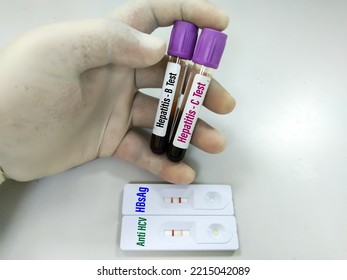 Blood Sample For Hepatitis A, B And C Test With Rapid Test Kit. Showing Result Positive. To Diagnosis Liver Jaundice