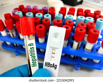 Blood Sample For Hepatitis A, B And C Test With Rapid Test Kit. Showing Result Positive. To Diagnosis Liver Jaundice