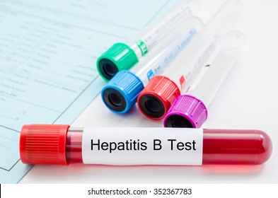 Blood Sample For Hepatitis B Virus (HBV) Testingl On Request Form Screening Test.