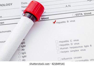 Blood Sample For Hepatitis B Virus (HBV) Testing On Request Form Screening Test.