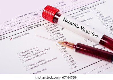 Blood Sample For Hepatitis B Virus (HBV) Testingl On Request Form Screening Test.