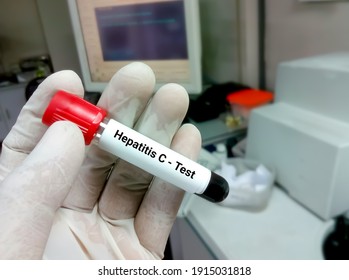 Blood Sample For Hepatitis C Virus (HCV) Testing, Anti-hcv