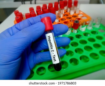 Blood Sample For Hepatitis C Virus (HCV) Testing