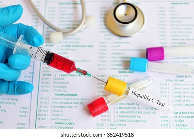 Blood Sample For Hepatitis C Virus (HCV) Testing