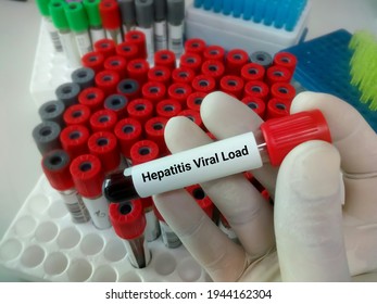 Blood Sample For Hepatitis Viral Load Test