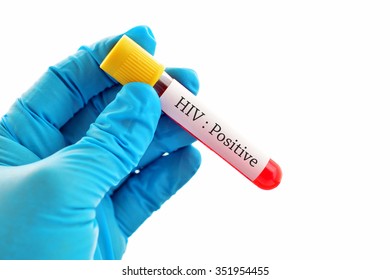 Blood Sample With HIV Positive