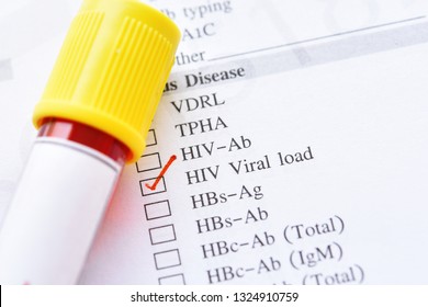 Blood Sample For HIV RNA Or HIV Viral Load Test