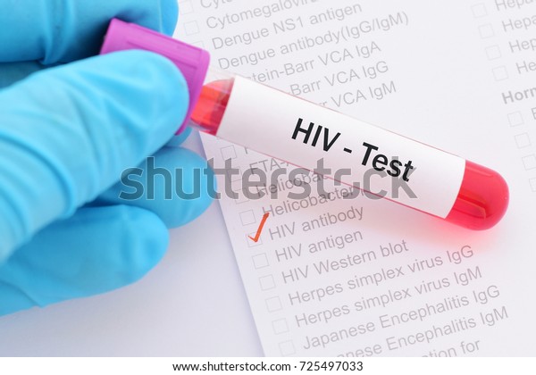Blood sample for HIV\
test\
