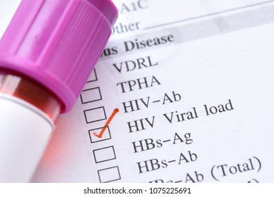 Blood Sample For HIV Viral Load Testing