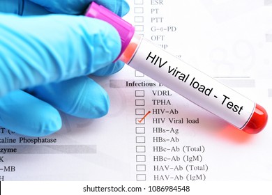 Blood Sample For HIV Viral Load Test