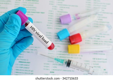 Blood Sample For HIV Viral Load Testing