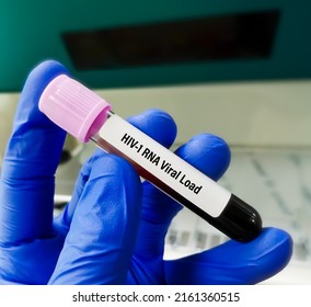 Blood Sample For HIV-1 RNA Viral Load Test.