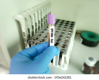 
Blood Sample For HPV DNA Test, Human Papilloma Virus, Cervical Cancer