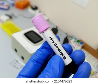 Blood Sample For Human Papillomavirus (HPV) Genotyping Testing In PCR Laboratory