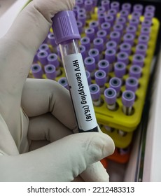 Blood Sample For Human Papillomavirus (HPV) Genotyping Testing In PCR Laboratory. HrHPV Genotypes Test.