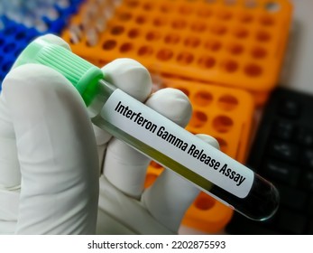 Blood Sample For Interferon Gamma Release Assay (IGRA) Test For Diagnosis Of Tuberculosis