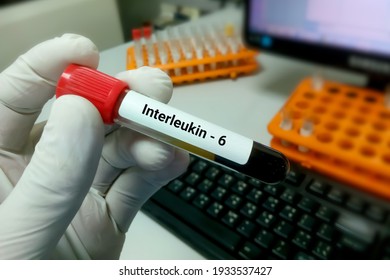 Blood Sample For Interleukin 6 Or IL-6 Test, Inflammatory Cytokine, Anti Inflammatory Myokine