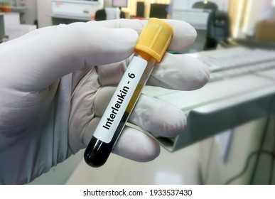 Blood Sample For Interleukin 6 (IL-6) Test, Inflammatory Cytokine, Anti Inflammatory Myokine