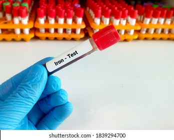 Blood Sample For Iron Test. Anemia. Iron Deficiency Anemia