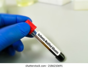 Blood Sample For Ischemia Modified Albumin (IMA) Test, A Marker Of Myocardial Ischemia. Percutaneous Coronary Intervention (PCI).