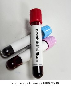 Blood Sample For Ischemia Modified Albumin (IMA) Test, A Marker Of Myocardial Ischemia. Percutaneous Coronary Intervention (PCI).