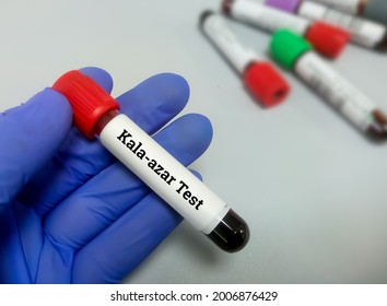Blood sample for Kala-azar test with laboratory background. Visceral leishmaniasis (VL)