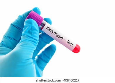 Blood sample for karyotype (abnormal chromosome study) testing
