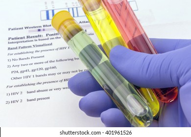 Blood sample and lab request for anti-HIV testing