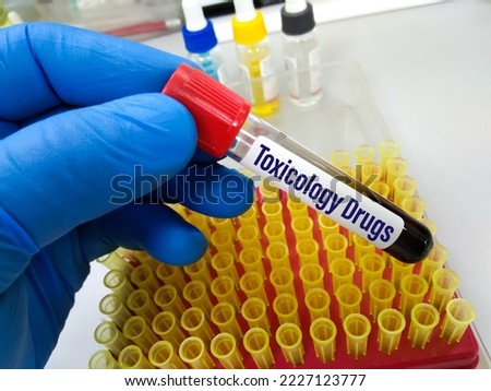 blood sample with laboratory background for Toxicology drug testing
