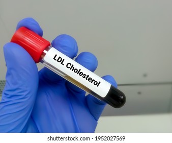 Blood sample for LDL cholesterol test, LDL-C, Bad cholesterol