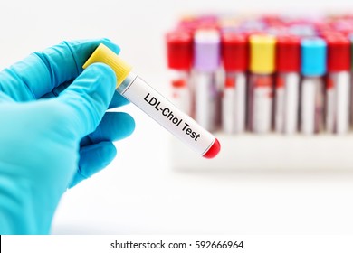 Blood sample for LDL-cholesterol test