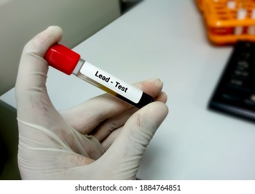 Blood Sample For Lead (Pb) Test. Blood Toxicity Testing